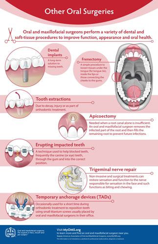 other_surgeries_infographic_tile